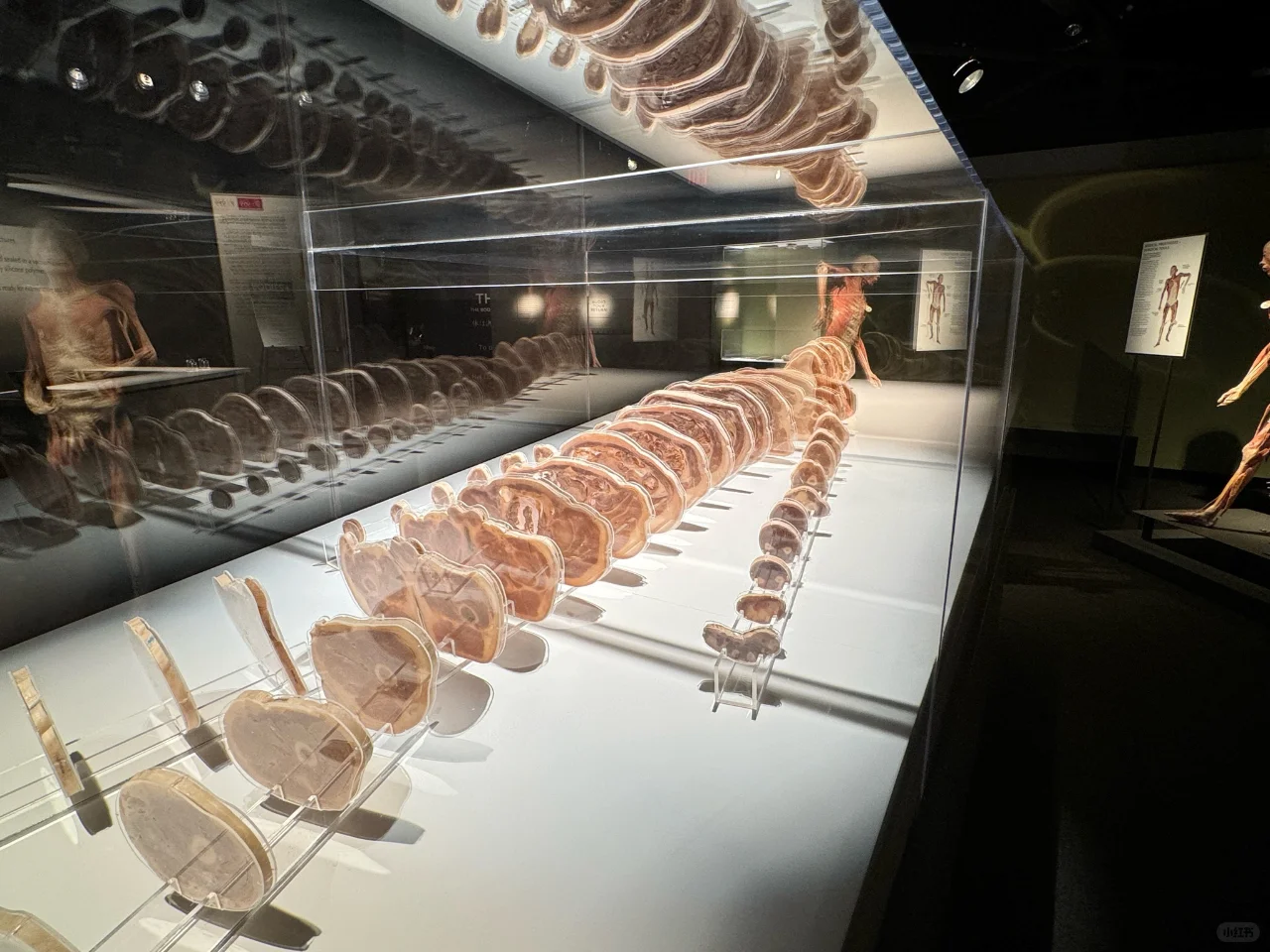 "Las Vegas Bodies Exhibition: A Sobering Reality Check That Will Instantly Bring You Back to Earth!"